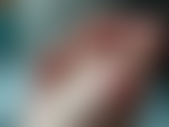 Understanding Peripheral Artery Disease and Its Impact on Diabetic Patients