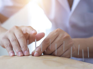 Hot Flashes and Mood Swings? How Acupuncture Help You Find Your Cool!