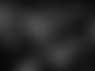 Attention Becomes the Scarcest Resource in the AI Era