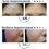 Thumbnail: FetoScell anti-aging cream with exosomes, NK cells, and collagen for skin rejuvenation