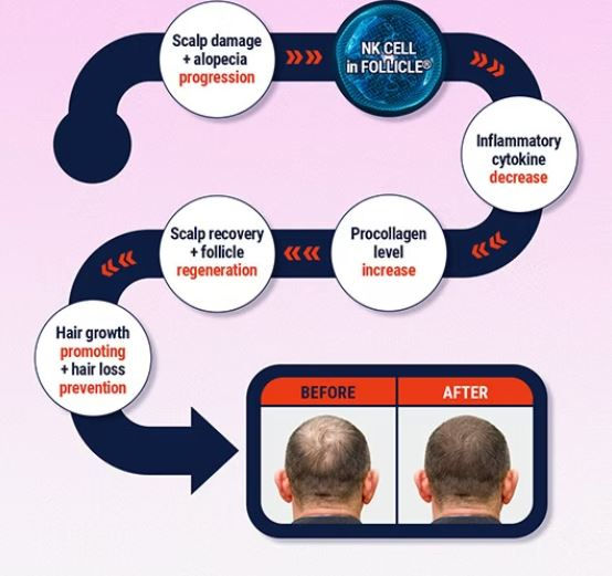 Thumbnail: FetoScell Follicle Hair Tonic bottle promoting hair growth and scalp health