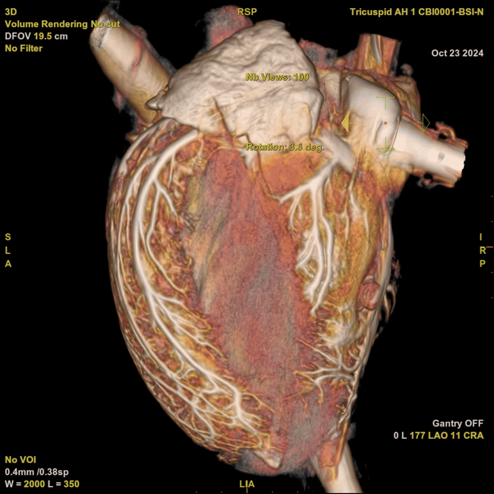 BioSim_GEAllia_ExVivoHeart.gif