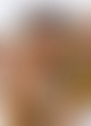 Por que as taxas de câncer estão subindo em pessoas mais jovens?