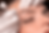 DHI Eyebrow Restoration