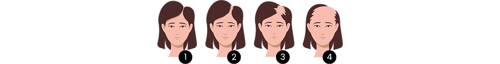 female-hair-loss-scales.png