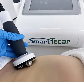 TECAR THERAPY