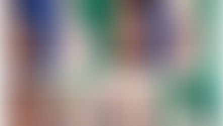 upturned nose + glabella line + dissolving filler + columella inserting(closed rhinoplasty)