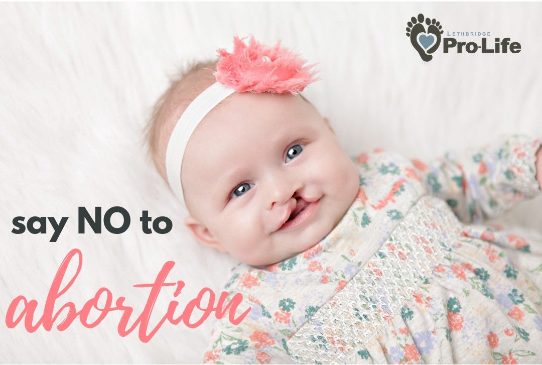 say no to abortion2.jpg