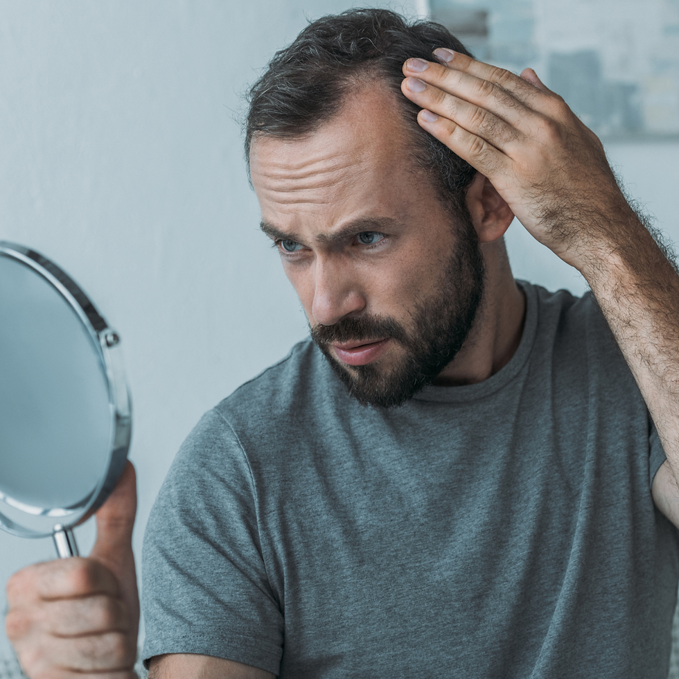 un Homme qui se regarde dans un miroir car il perd ses cheveux