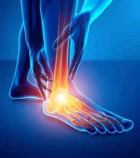 Ankle Pain.webp