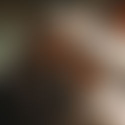 A new therapy for Alzheimer