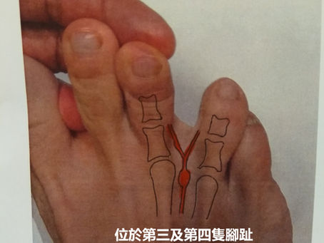 腳板底行路痛 – 可能係咩?