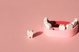 Cavities