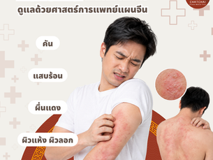 🌿 ผื่นแพ้อักเสบ (Eczema) ดูแลอย่างไรตามศาสตร์การแพทย์แผนจีน?