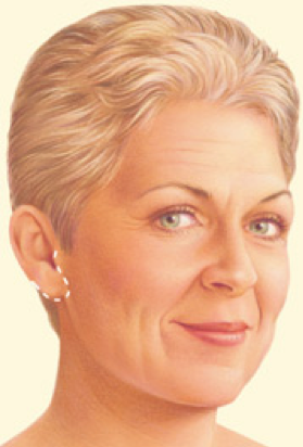 Facelift 3.png