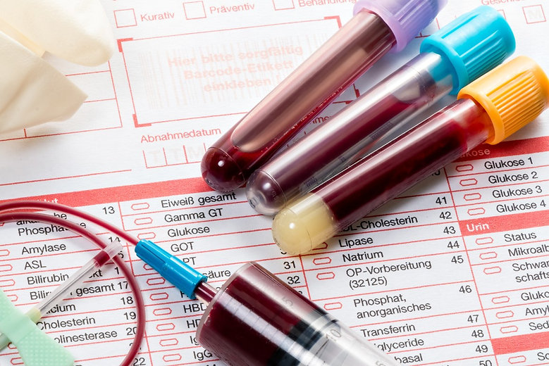 Cancer Test.jpeg