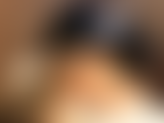 How does cupping impact stress relief?