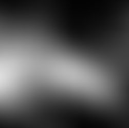 Vocal problems of professional singer! Oliver's Story!