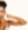 ACNE-1_edited.jpg