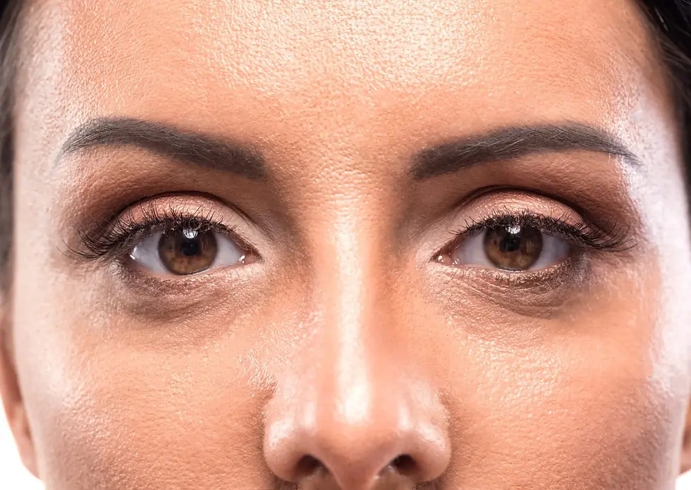 Eyelid rejuvenation solutions at Simply You Med Spa, Evergreen & Conifer.