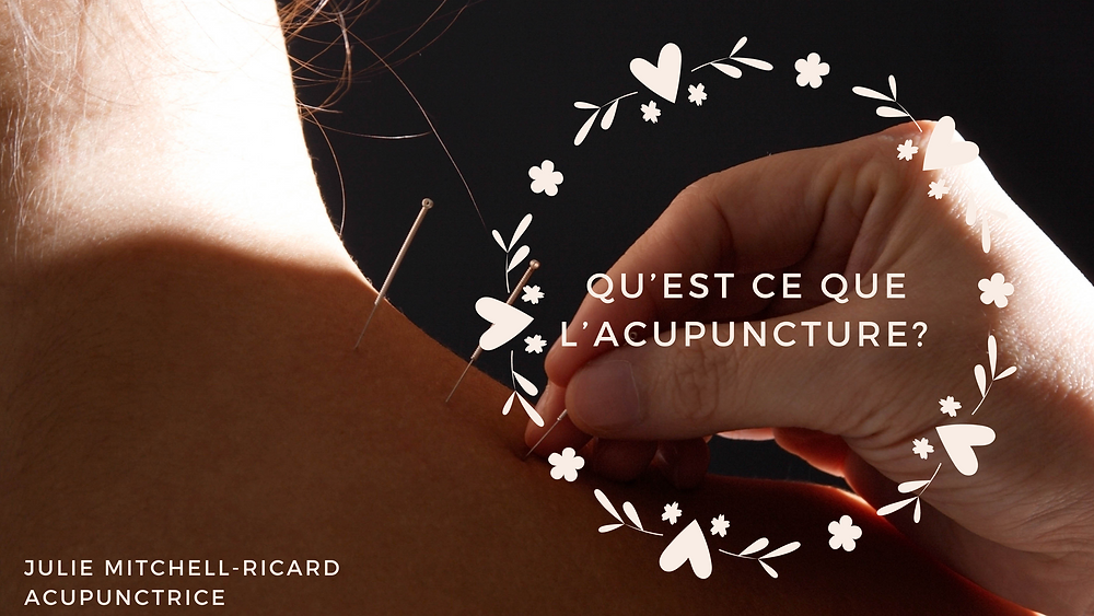 Qu'est-ce que l'acupuncture et comment ça fonctionne