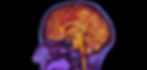 brain_white_bg.jpg