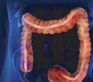 Therapy for Patients with Previously Treated Metastatic Colorectal Cancer (mCRC)