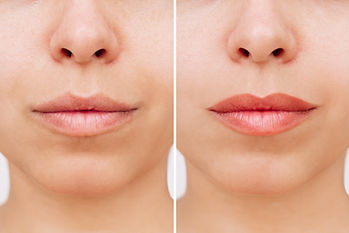 Result of lip tattooing. Cropped shot of young woman's lower part of face with lips before