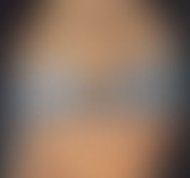 POUSSEE D’ARTHROSE DU SPORTIF