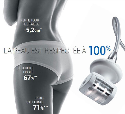 lpg-endermologie-corps.jpg
