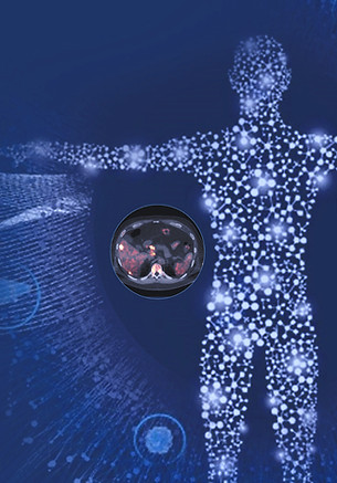 Total MI for Theranostics-article image_