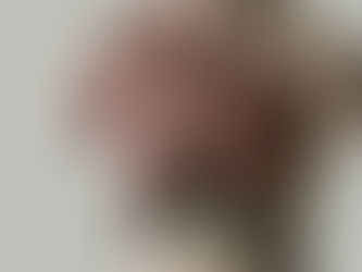 # Hepatitis... una afección de cuidado