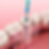 Endodoncia