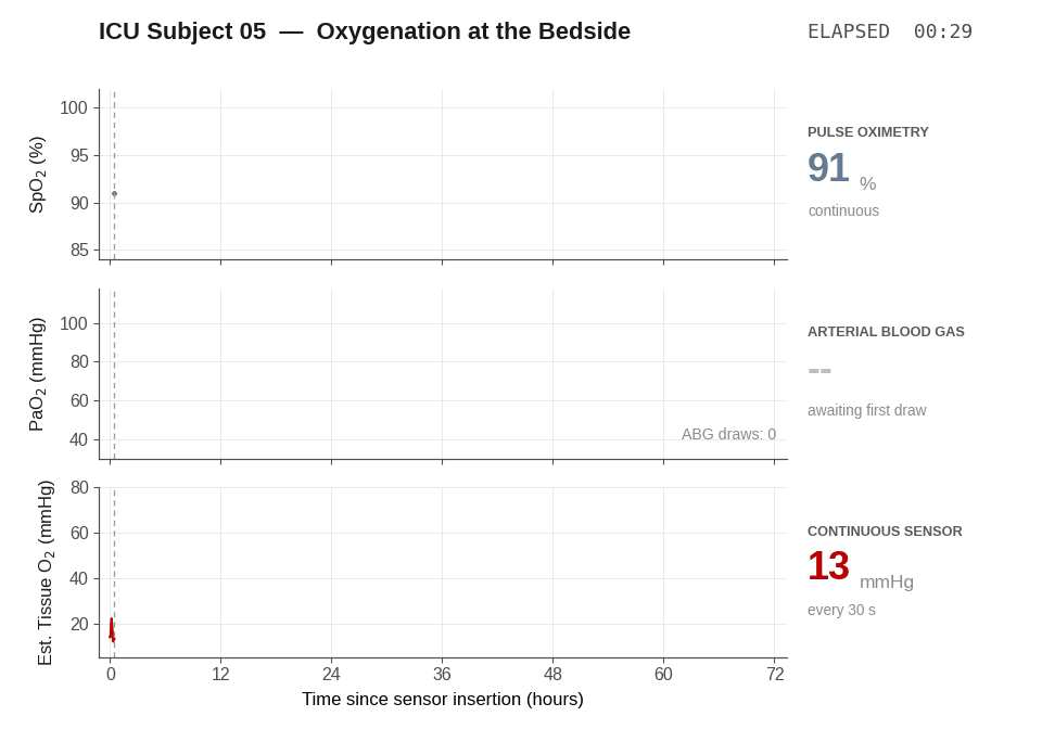 ICU_Subject_05_oxygen_realtime_simultaneous.gif