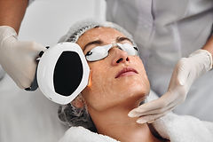 PIH Laser Treatment: Evidence-Based Options for Post-Inflammatory Hyperpigmentation Management in Singapore