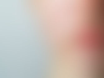 Close-up of facial cheeks showing red spots and skin irritation, illustrating common causes and appearance of red spots on skin