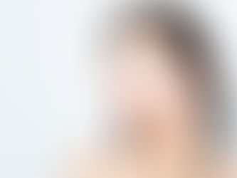 Woman touching her cheeks while examining her skin, concerned about acne marks vs acne scars