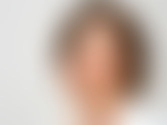 Woman with smooth skin gently touching her cheek, representing skincare and hyperpigmentation treatment options in Singapore