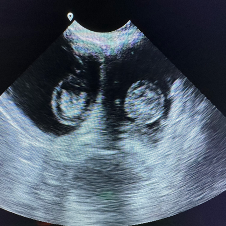 Understanding the Cost of Ultrasound Machines: A Guide for Veterinary Professionals