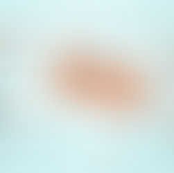 5 Most Common Types of Dog Eye Injuries: How to Spot, Diagnose, and Treat