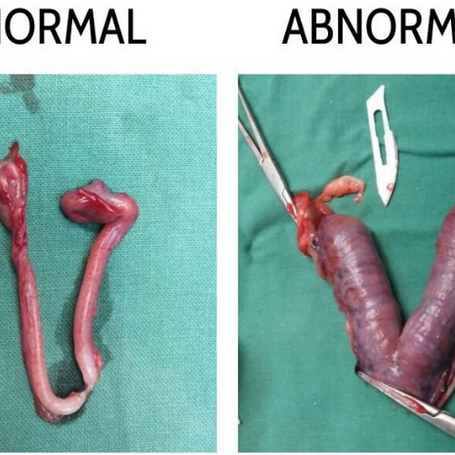 Understanding and Managing Pyometra in Dogs