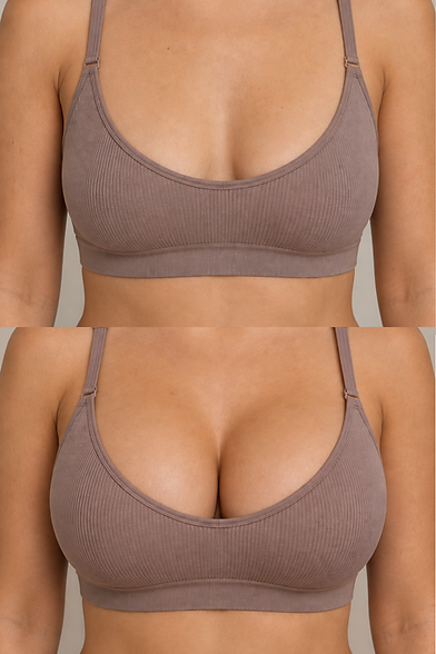 Woman representing breast augmentation surgery