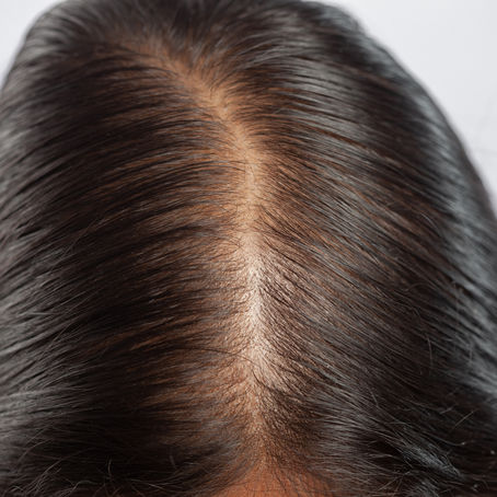 The Importance of Scalp Care in Hair Loss Prevention and Extension Longevity 