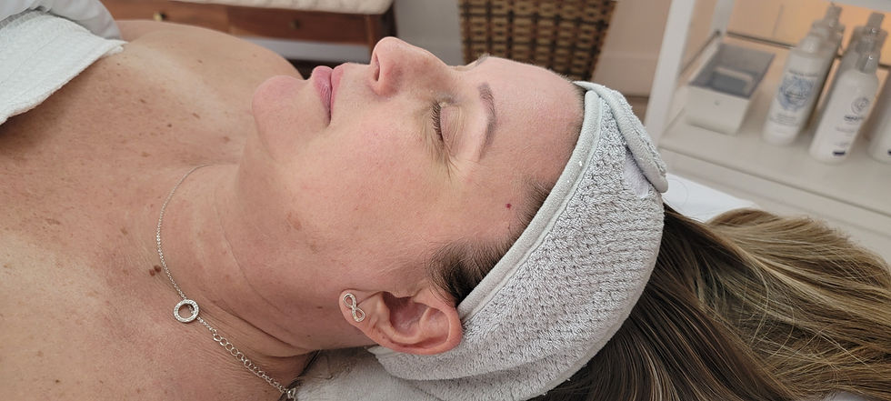 Angelique Hydro Facial Lft Side Before.jpg