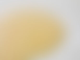 Why Miami Residents Swear by Hydrafacials for Consistently Glowing Skin