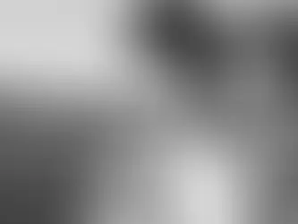 The Ultimate Guide to Jaw Enhancement: Procedure, Recovery, and Results