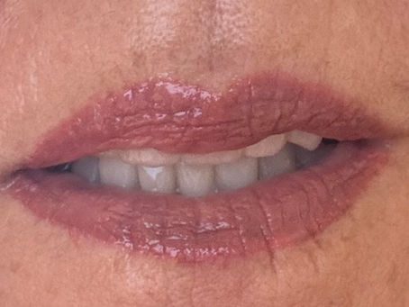 Female lips post blushing procedure