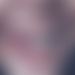 אחת ולתמיד - המחקר שבדק האם קשתיות שקופות יעילות כמו גשר מברזל?