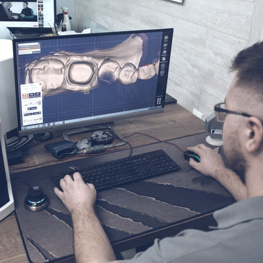 כיצד מיוצרות קשתיות שקופות ליישור שיניים שקוף?