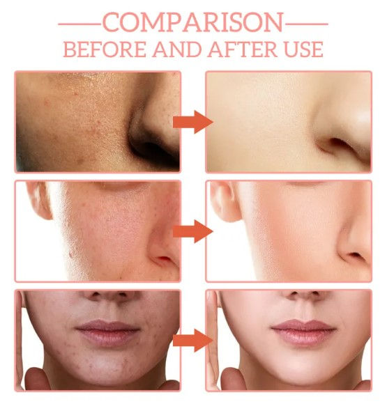 5-in-1 Radiant Skin Serum
